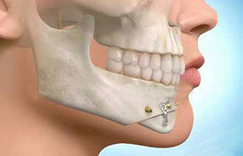 maxillo facial specialist